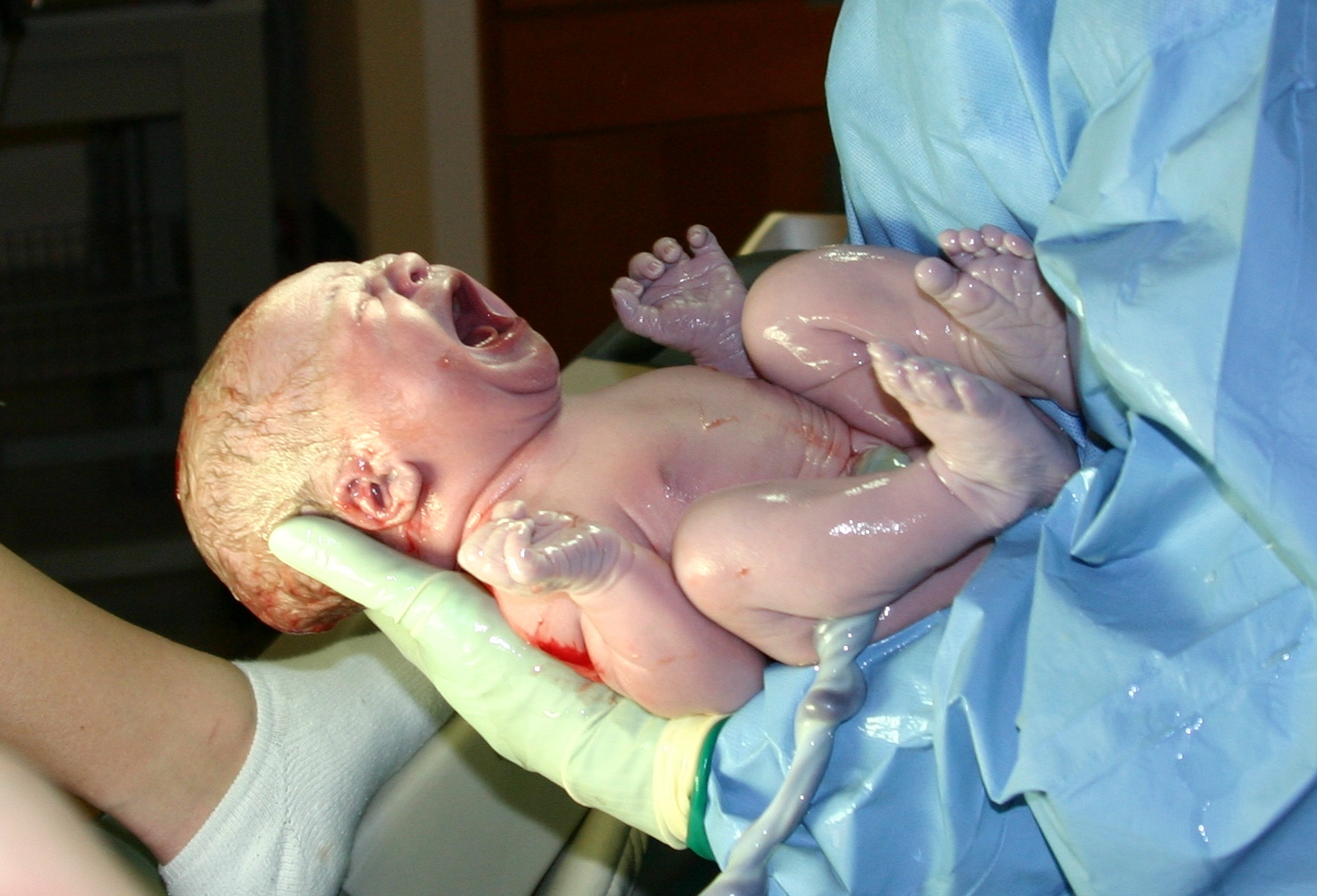 A newborn girl held in a gloved hand seconds after birth, still wet, the cord attached, mouth wide open in a cry, her arms and legs bent close to her body