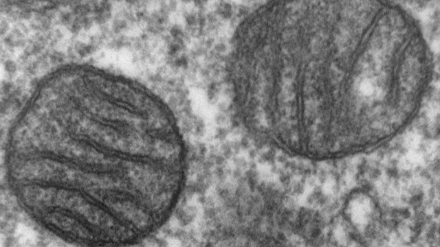 Electron micrograph of two mitochondria, their folded inner membranes visible as dark lines
