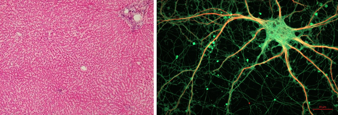 Left: a slice of human liver stained pink, its cells packed in tight rows. Right: a single rat nerve cell glowing green on black, with long branching arms